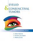 eyelid_conjunctival_tumors